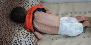 غزة تسجل وفاة جديدة بسبب المجاعة والحصيلة ترتفع إلى 162 حالة بينهم 92 طفلا - بلس 48
