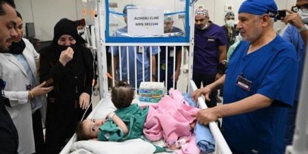 نجاح عملية فصل التوأم السيامي السوري «سيلين وإيلين» - بلس 48