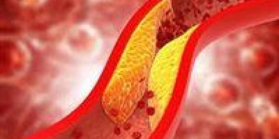فواكه تُنقذ القلب من الكولسترول.. 9 أنواع طبيعية بخواص دوائية مذهلة - بلس 48