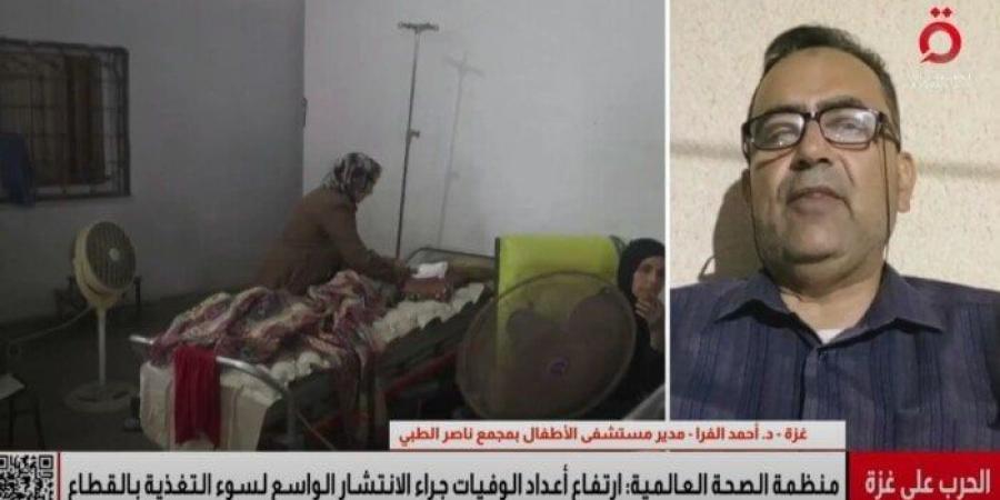 مدير مستشفى الأطفال بمجمع ناصر الطبي: كارثة سوء التغذية تحاصر أطفال غزة في ظل نقص الغذاء والدواء - بلس 48