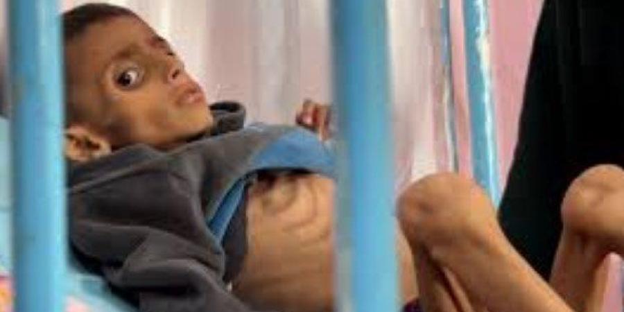 «الصحة الفلسطينية»: نسبة عجز الأدوية بلغت 52% بغزة.. والمجاعة تقتل الأطفال والبالغين - بلس 48