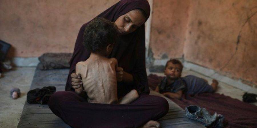 5 وفيات بينهم طفلان نتيجة المجاعة وسوء التغذية في قطاع غزة - بلس 48